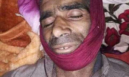 Civilian Injured In Shopian Gunfight Succumbs After 27 Days