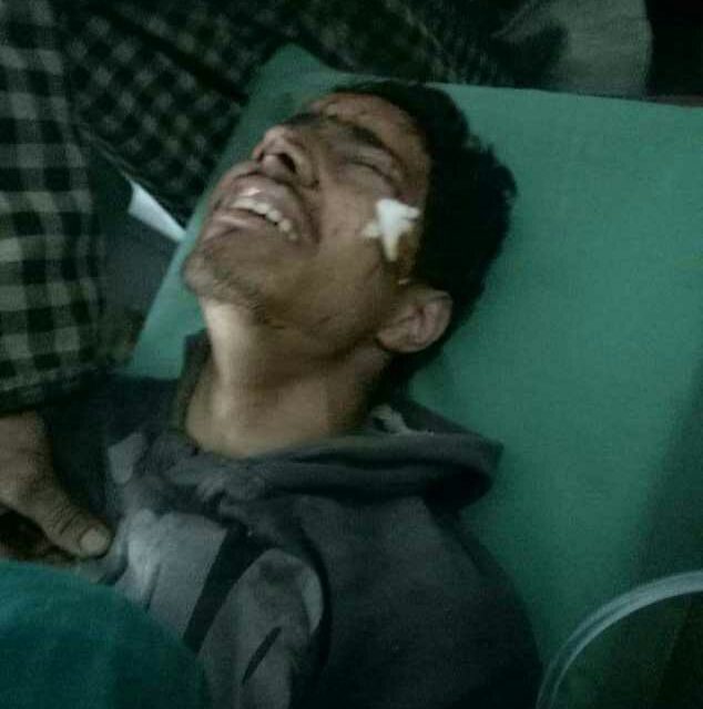 Two labourers injured in Khandroo explosion