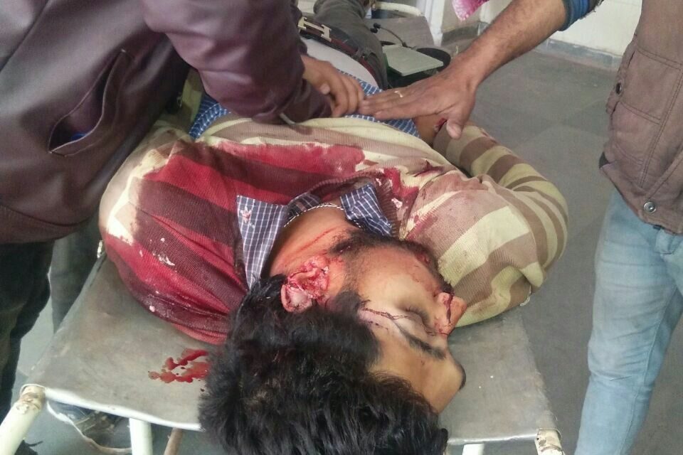 SPO injured in accidental firing in J&K