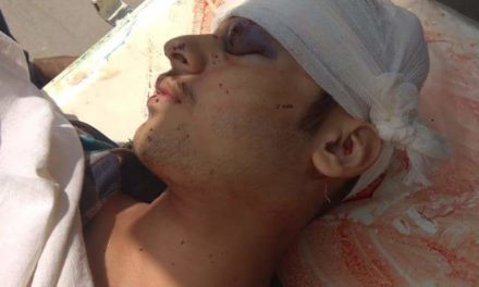 Civilian Wounded In Shopian Clashes Succumbs