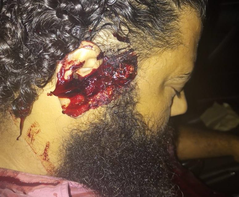 Kupwara man shot dead in Srinagar.