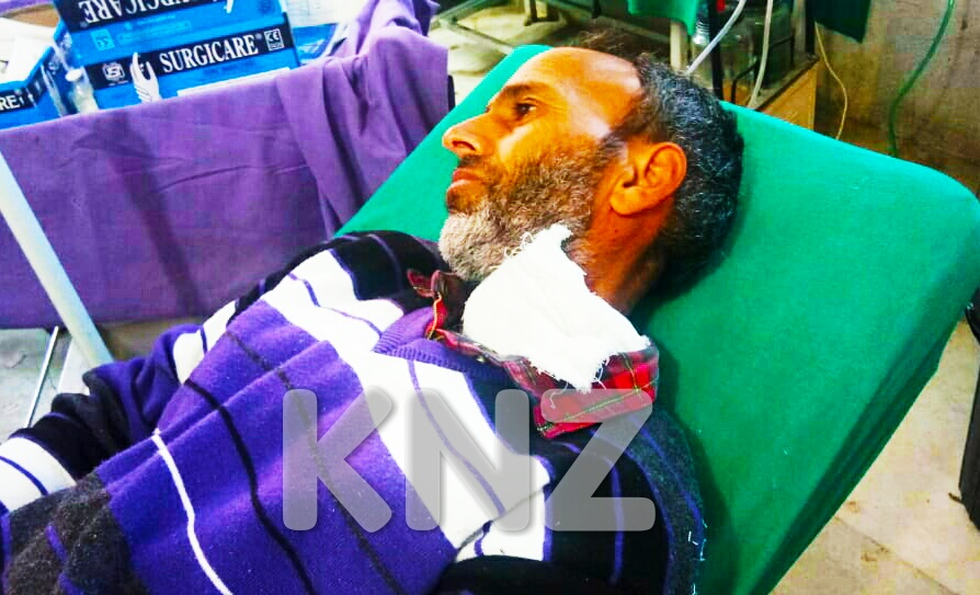 Dog bite cases on rise in Kulgam,Dogs bite 10 persons in a single day