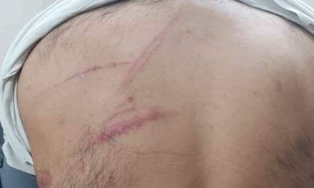 Kashmiri student attacked with knife, iron rods in Chandigarh