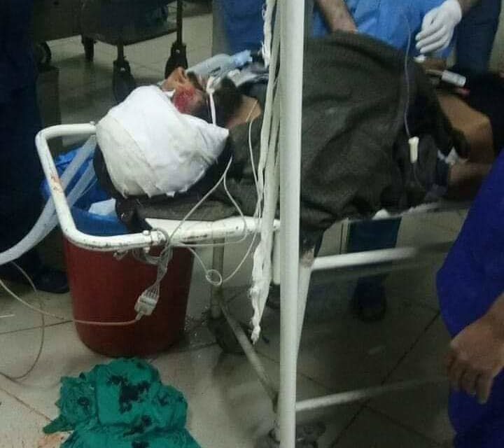 Budgam man injured in Chattergam firing incident succumbs at SKIMS