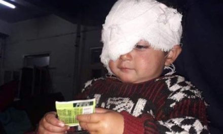 Rs 1 lakh assistance provided to pellet victim Hiba