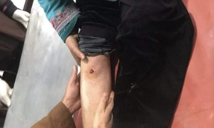 Woman recieves bullet injury, locals protest in Budgam village