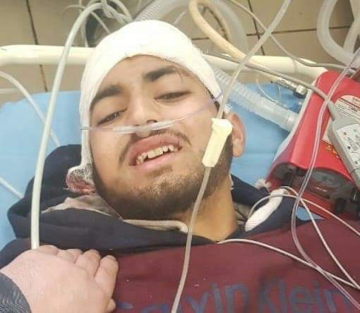 Teenager critically injured after hit by CRPF vehicle at Saida Kadal