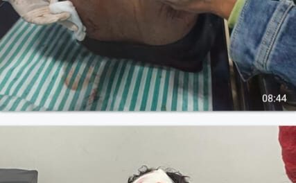 Rishabh Pant has two cuts on forehead, ligament tear in his right knee, suffered abrasion injuries on back: BCCI