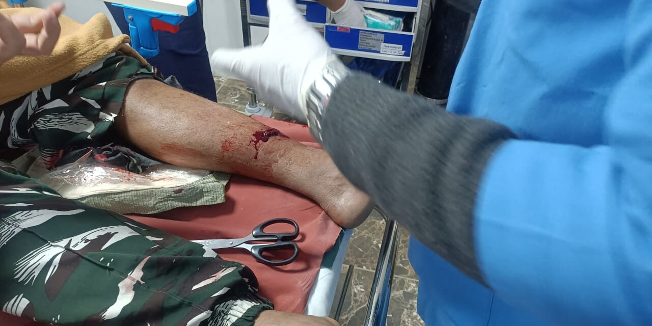CRPF man injured after biker slipped his bike in Srinagar