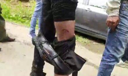 Amid reports of leopard sighting, man injured in “animal attack” in Srinagar’s Badamwari