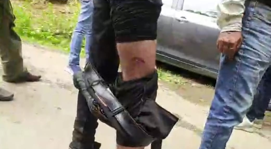 Amid reports of leopard sighting, man injured in “animal attack” in Srinagar’s Badamwari