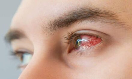 Eye flu on decline in J&K; 29K cases reported so far